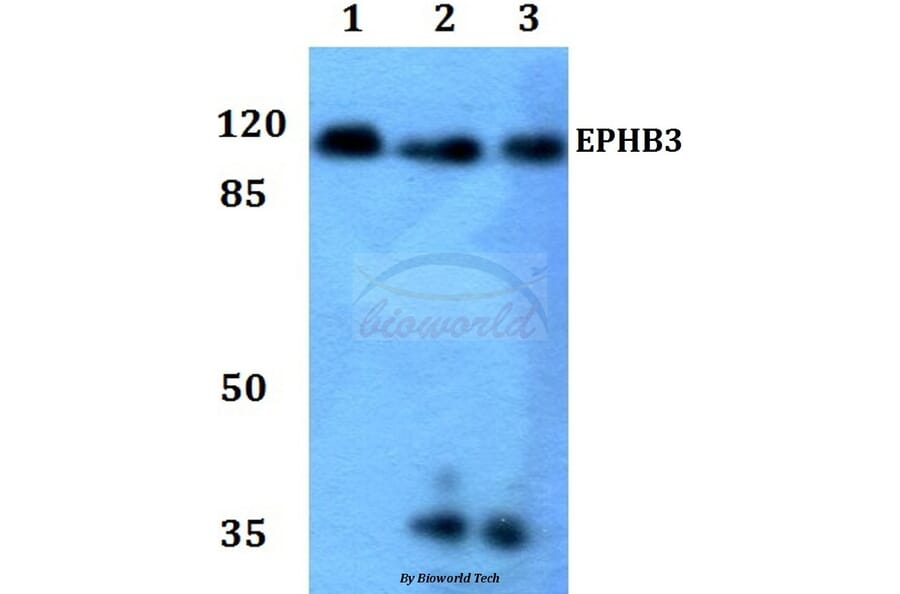 Anti-EphB3 Antibody from Bioworld Technology (BS60027) - Antibodies.com