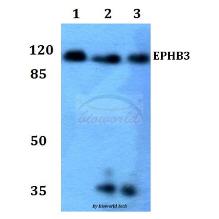 Anti-EphB3 Antibody from Bioworld Technology (BS60027) - Antibodies.com