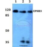 Anti-EphB3 Antibody from Bioworld Technology (BS60027) - Antibodies.com