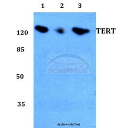 Anti-TERT Antibody from Bioworld Technology (BS60032) - Antibodies.com