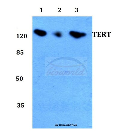 Anti-TERT Antibody from Bioworld Technology (BS60032) - Antibodies.com