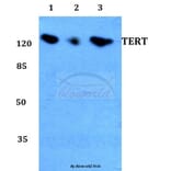 Anti-TERT Antibody from Bioworld Technology (BS60032) - Antibodies.com