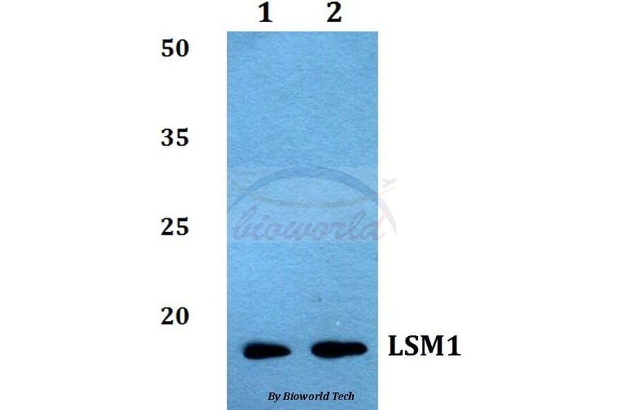 Anti-LSM1 Antibody from Bioworld Technology (BS60034) - Antibodies.com