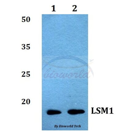 Anti-LSM1 Antibody from Bioworld Technology (BS60034) - Antibodies.com