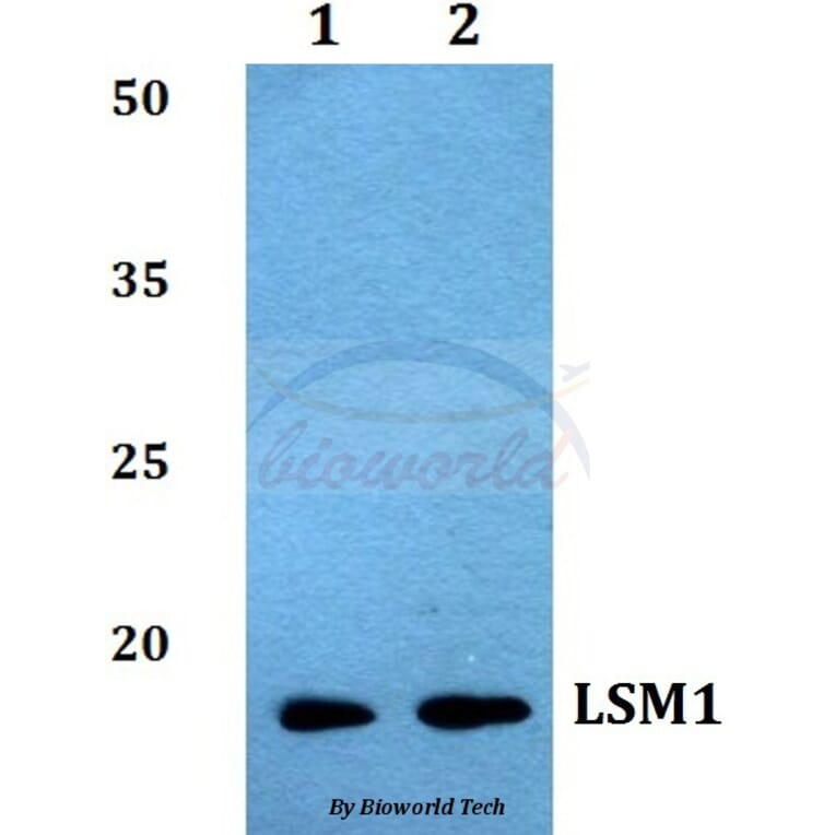 Anti-LSM1 Antibody from Bioworld Technology (BS60034) - Antibodies.com