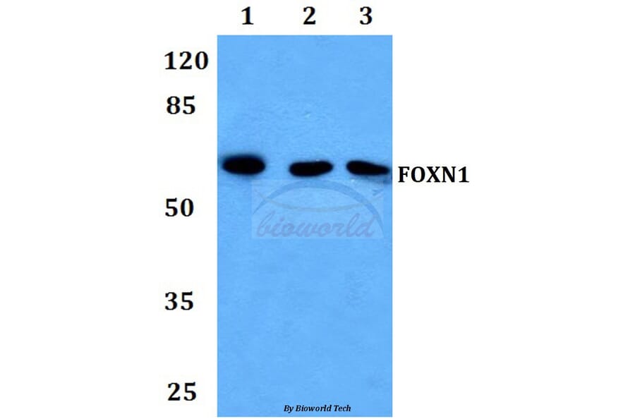 Anti-FOXN1 Antibody from Bioworld Technology (BS60036) - Antibodies.com