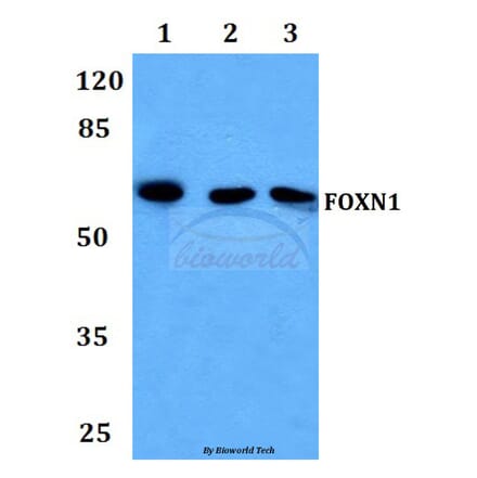 Anti-FOXN1 Antibody from Bioworld Technology (BS60036) - Antibodies.com