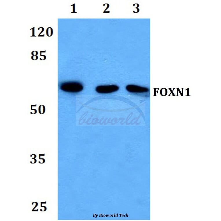 Anti-FOXN1 Antibody from Bioworld Technology (BS60036) - Antibodies.com