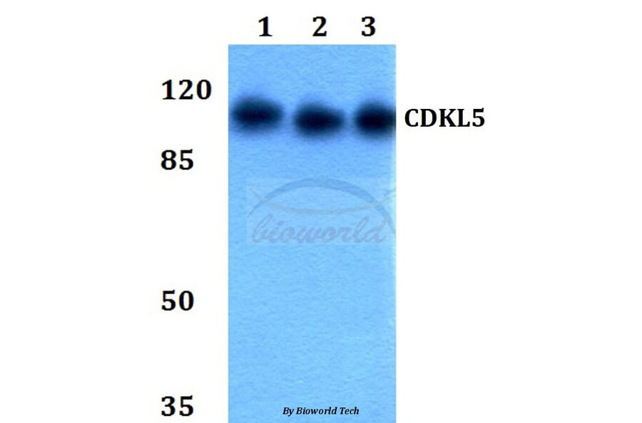 Anti-CDKL5 Antibody from Bioworld Technology (BS60038) - Antibodies.com