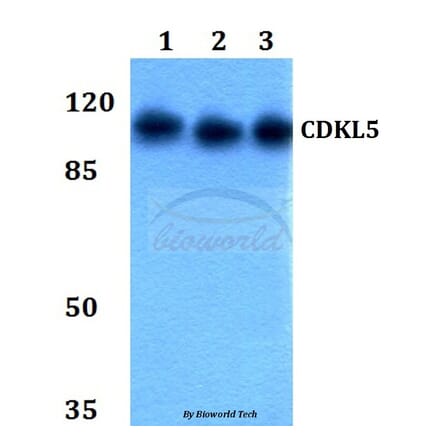 Anti-CDKL5 Antibody from Bioworld Technology (BS60038) - Antibodies.com