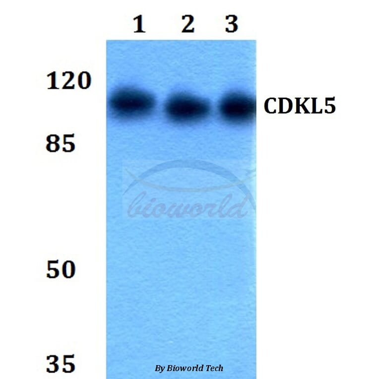 Anti-CDKL5 Antibody from Bioworld Technology (BS60038) - Antibodies.com