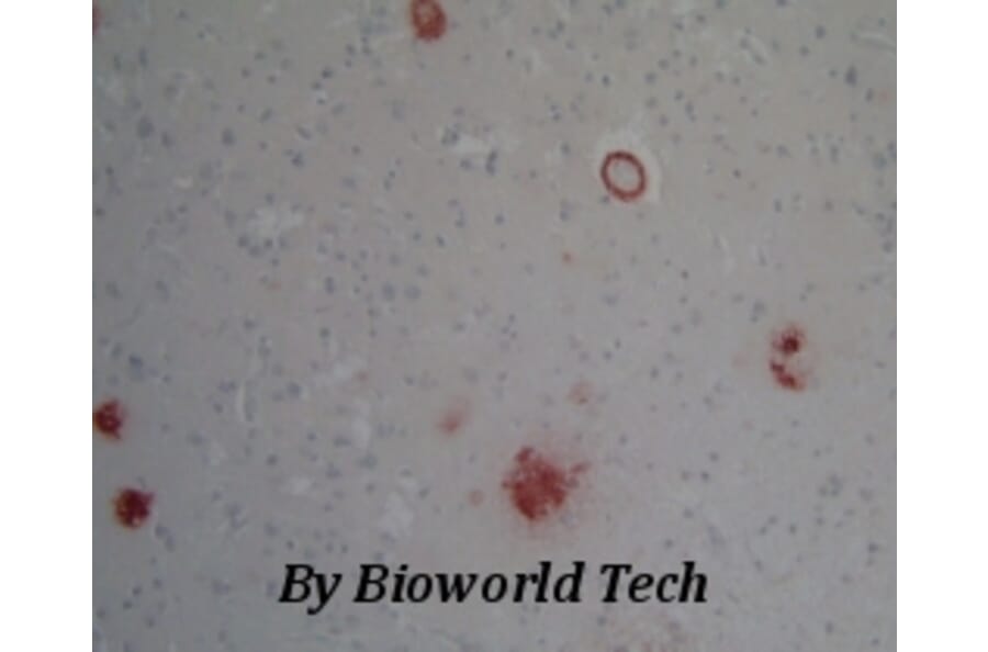 Anti-OLFM1 Antibody from Bioworld Technology (BS6004) - Antibodies.com