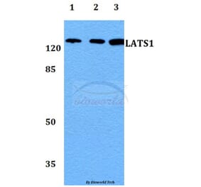 Anti-LATS1 Antibody from Bioworld Technology (BS60042) - Antibodies.com