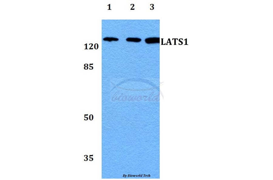 Anti-LATS1 Antibody from Bioworld Technology (BS60042) - Antibodies.com