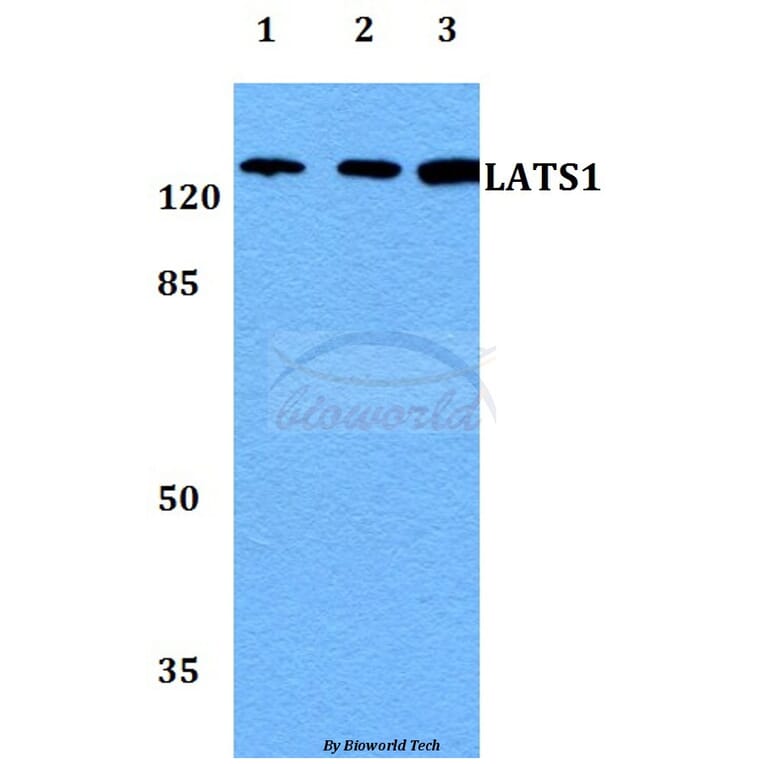 Anti-LATS1 Antibody from Bioworld Technology (BS60042) - Antibodies.com