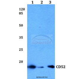 Anti-CD52 Antibody from Bioworld Technology (BS60045) - Antibodies.com