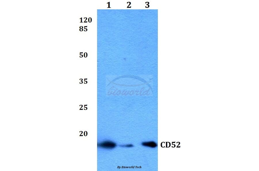 Anti-CD52 Antibody from Bioworld Technology (BS60045) - Antibodies.com