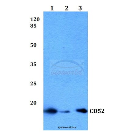 Anti-CD52 Antibody from Bioworld Technology (BS60045) - Antibodies.com