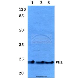 Anti-VHL Antibody from Bioworld Technology (BS60046) - Antibodies.com