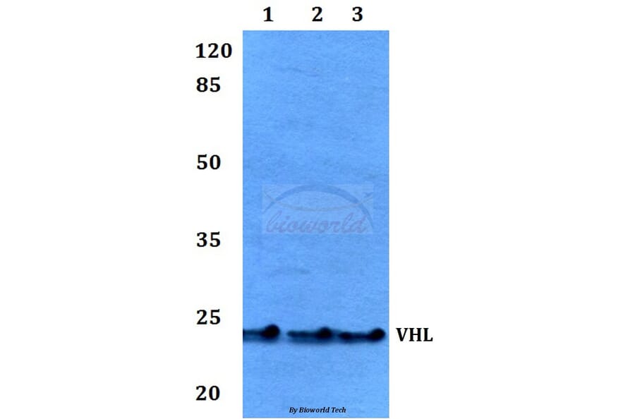 Anti-VHL Antibody from Bioworld Technology (BS60046) - Antibodies.com
