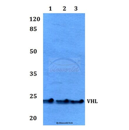 Anti-VHL Antibody from Bioworld Technology (BS60046) - Antibodies.com