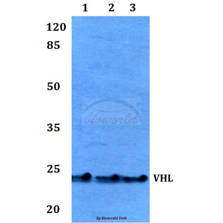 Anti-VHL Antibody from Bioworld Technology (BS60046) - Antibodies.com