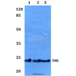Anti-VHL Antibody from Bioworld Technology (BS60046) - Antibodies.com