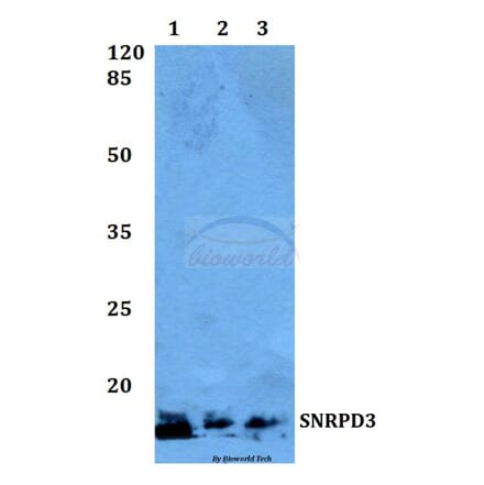 Anti-SNRPD3 Antibody from Bioworld Technology (BS60048) - Antibodies.com