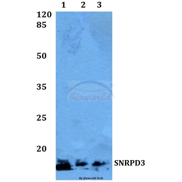Anti-SNRPD3 Antibody from Bioworld Technology (BS60048) - Antibodies.com