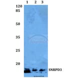 Anti-SNRPD3 Antibody from Bioworld Technology (BS60048) - Antibodies.com