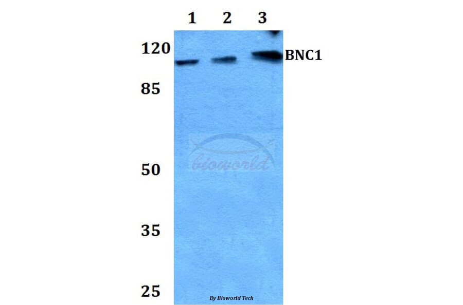 Anti-BNC1 Antibody from Bioworld Technology (BS60049) - Antibodies.com