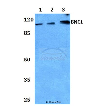 Anti-BNC1 Antibody from Bioworld Technology (BS60049) - Antibodies.com