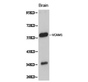 Anti-VCAM1 Antibody from Bioworld Technology (BS6005) - Antibodies.com