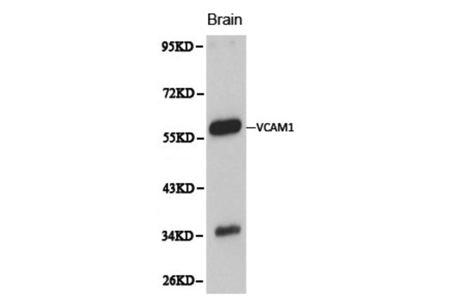 Anti-VCAM1 Antibody from Bioworld Technology (BS6005) - Antibodies.com