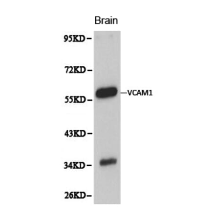 Anti-VCAM1 Antibody from Bioworld Technology (BS6005) - Antibodies.com