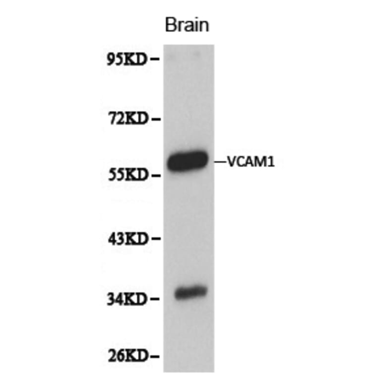 Anti-VCAM1 Antibody from Bioworld Technology (BS6005) - Antibodies.com