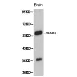 Anti-VCAM1 Antibody from Bioworld Technology (BS6005) - Antibodies.com