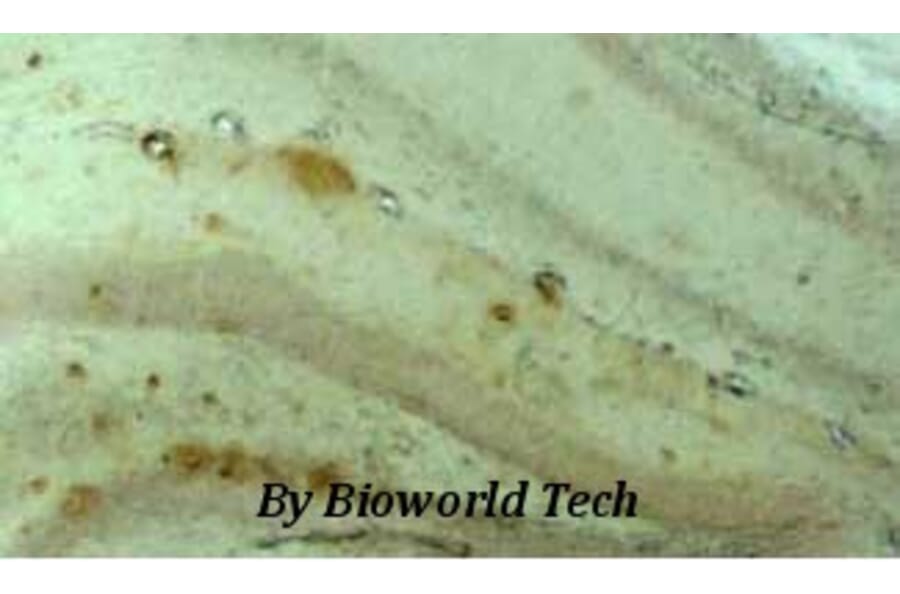 Anti-VCAM1 Antibody from Bioworld Technology (BS6005) - Antibodies.com