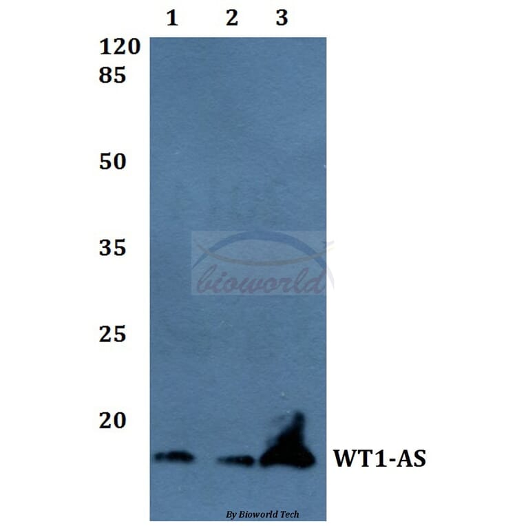 Anti-WT1-AS Antibody from Bioworld Technology (BS60050) - Antibodies.com