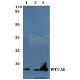 Anti-WT1-AS Antibody from Bioworld Technology (BS60050) - Antibodies.com