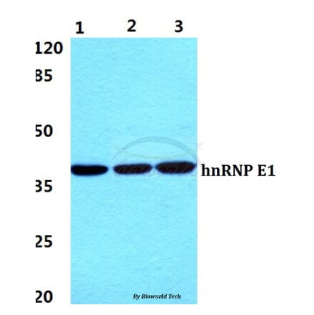 Anti-hnRNP E1 Antibody from Bioworld Technology (BS60055) - Antibodies.com