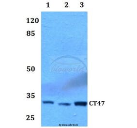 Anti-CT47 Antibody from Bioworld Technology (BS60056) - Antibodies.com