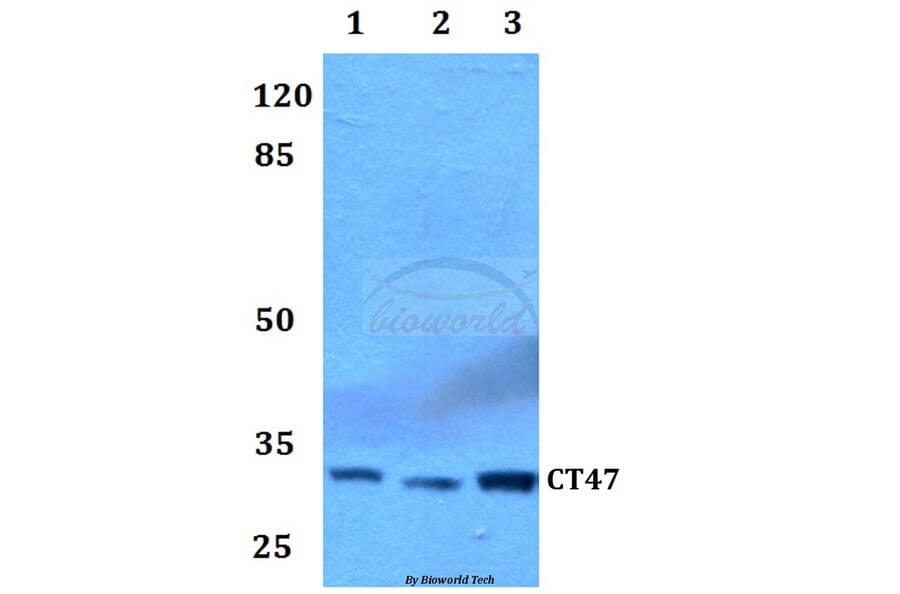 Anti-CT47 Antibody from Bioworld Technology (BS60056) - Antibodies.com