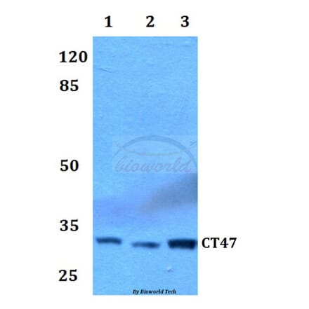 Anti-CT47 Antibody from Bioworld Technology (BS60056) - Antibodies.com