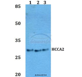Anti-HCCA2 Antibody from Bioworld Technology (BS60058) - Antibodies.com