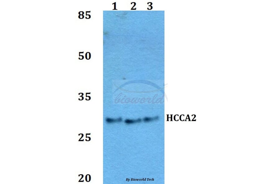 Anti-HCCA2 Antibody from Bioworld Technology (BS60058) - Antibodies.com