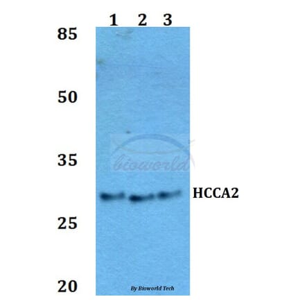 Anti-HCCA2 Antibody from Bioworld Technology (BS60058) - Antibodies.com