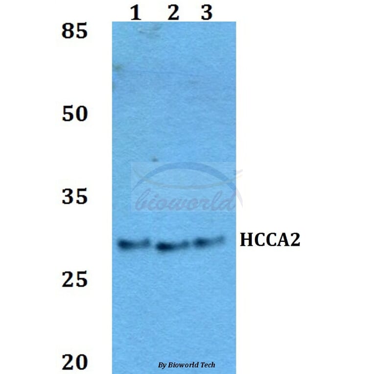 Anti-HCCA2 Antibody from Bioworld Technology (BS60058) - Antibodies.com