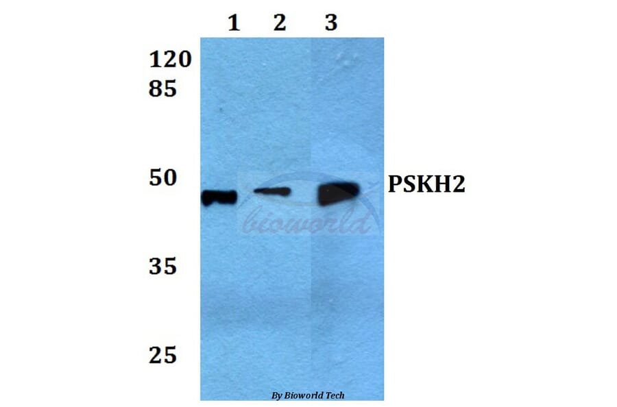 Anti-PSK-H2 Antibody from Bioworld Technology (BS60060) - Antibodies.com