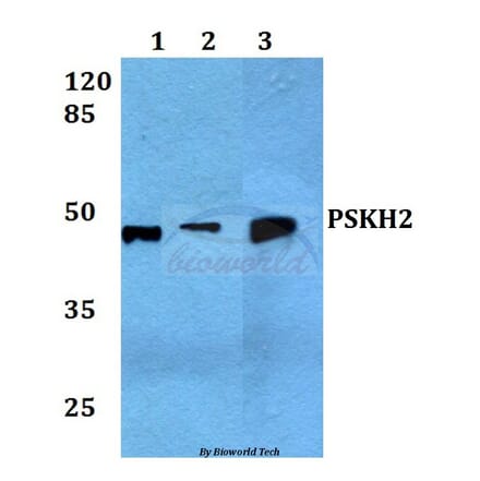 Anti-PSK-H2 Antibody from Bioworld Technology (BS60060) - Antibodies.com